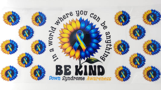 Down Syndrome 03